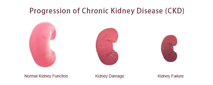 CKD chronic kidney disease