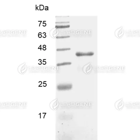 ZIKV NS1 Protein, His Tag, E. coli