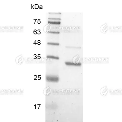 DENV NS1 Protein, His Tag, E. coli