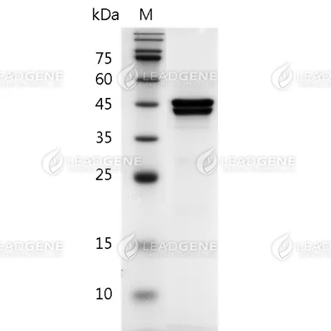 SARS-CoV-2 Nucleocapsid Protein, Tag Free, E. coli