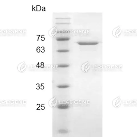 SARS-CoV-2 Spike Protein (S1 Subunit), His Tag, E. coli