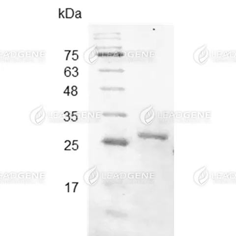 SARS-CoV-2 Spike Protein (RBD), His Tag, E. coli