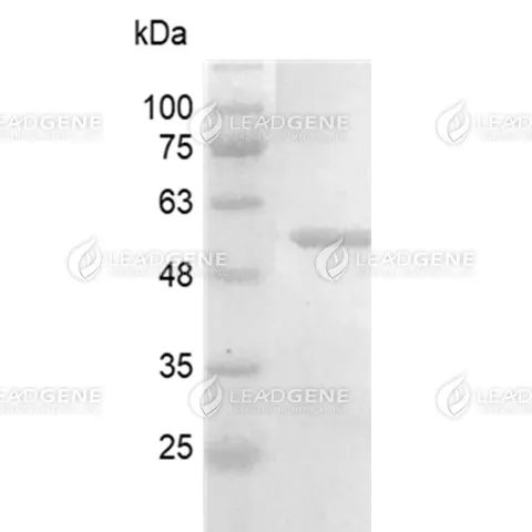 HCoV-OC43 Nucleocapsid Protein, His Tag, E. coli