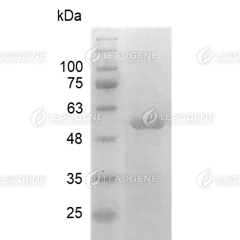 HCoV-HKU1 Nucleocapsid Protein, His Tag, E. coli