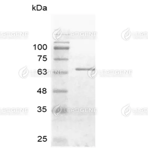 HCoV-229E Nucleocapsid Protein, His Tag, E. coli