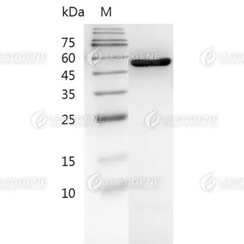 Influenza A H3N2 (A/Hong Kong/1/1968) Nucleocapsid Protein, His Tag, E. coli