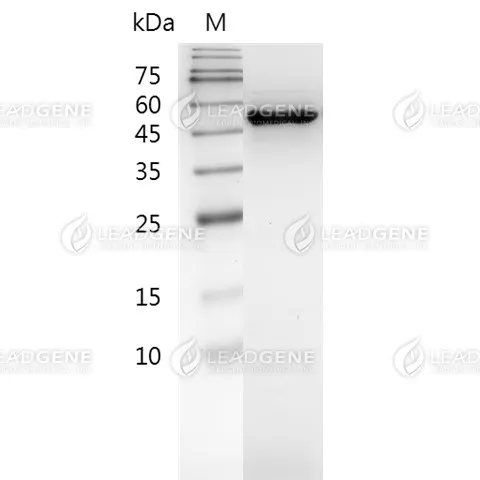 Influenza A H1N1 (A/New York/1682/2009) Nucleocapsid Protein, His Tag, E. coli