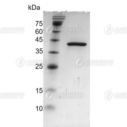 Human Respiratory Syncytial Virus A (RSV-A, Strain A2) Nucleocapsid Protein, His Tag, E. coli