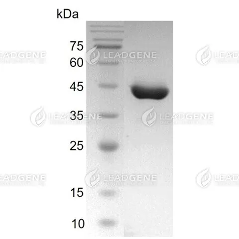 Human Respiratory Syncytial Virus A (RSV-A, Strain S2) Nucleocapsid Protein, His Tag, E. coli