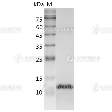 Monkeypox Virus (MPXV) L1R Protein, His Tag, E. coli