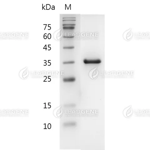 Enterovirus A71 (EV-A71) VP1 Protein, His Tag, E. coli