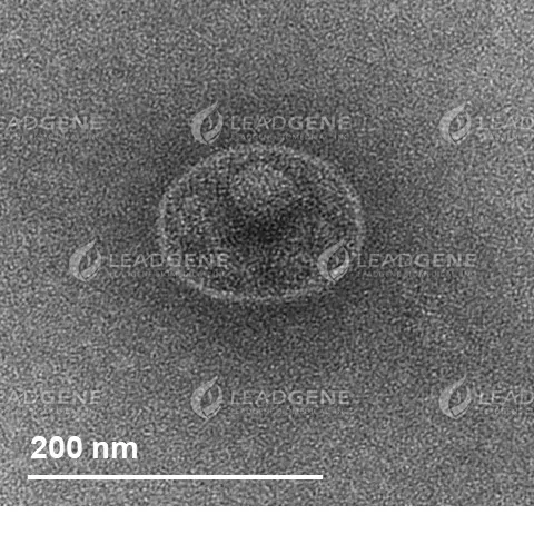 Representative TEM images of SARS-CoV-2 Virus-Like Particles The VLP size and morphology were assessed by negatively stained transmission electron microscopy (TEM). The scale bar is 200 nm.