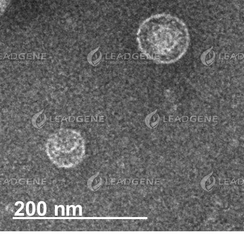Representative TEM images of SARS-CoV-2 Virus-Like Particles The VLP size and morphology were assessed by negatively stained transmission electron microscopy (TEM). The scale bar is 200 nm.