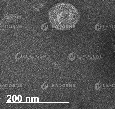 Representative TEM images of SARS-CoV-2 Virus-Like Particles The VLP size and morphology were assessed by negatively stained transmission electron microscopy (TEM). The scale bar is 200 nm.