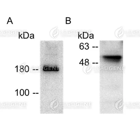 Purified SARS-CoV-2 VLPs were analyzed by Western blot using (A) Mouse anti-SARS-CoV-2 Spike mAb, clone LGSV201 (Cat. 18100) and (B) Anti-SARS-CoV-2 NP polyclonal antibody.