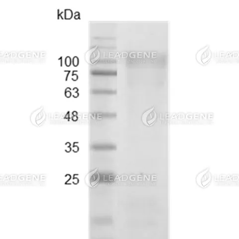 MERS-CoV Nucleocapsid Protein, His-SUMO Tag, HEK293