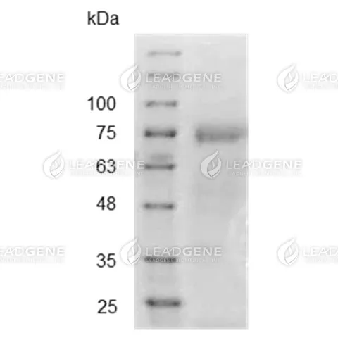 SDS-PAGE analysis of recombinant SARS-CoV nucleocapsid protein.
