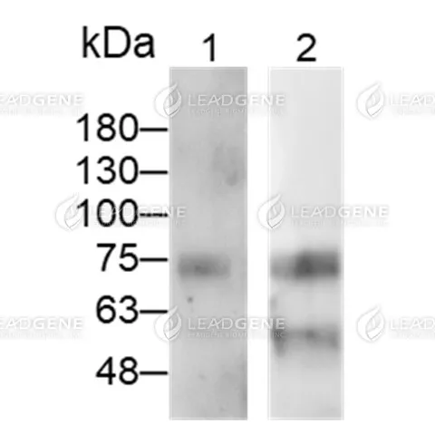 WB analysis of recombinant SARS-CoV nucleocapsid protein. Lane 1: Human anti-SARS-CoV &amp; CoV-2 NP Antibody (IgG), 0.5 μg/mL (Leadgene cat. 17901) Lane 2: Human anti-SARS-CoV &amp; CoV-2 NP Antibody (IgM), 0.5 μg/mL (Leadgene cat. 18301)