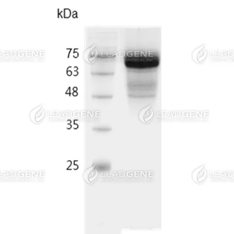 SDS-PAGE analysis of recombinant Human SARS-CoV-2 nucleocapsid protein.