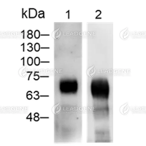 WB analysis of recombinant Human SARS-CoV-2 nucleocapsid protein. Lane 1: Human anti-SARS-CoV &amp; CoV-2 NP Antibody (IgG), 0.5 μg/mL (Leadgene cat. 17901) Lane 2: Human anti-SARS-CoV &amp; CoV-2 NP Antibody (IgM), 0.5 μg/mL (Leadgene cat. 18301)
