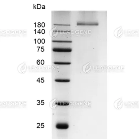 SARS-CoV-2 Trimeric Spike Protein (Delta B1.617.2 Variant), His Tag, HEK293