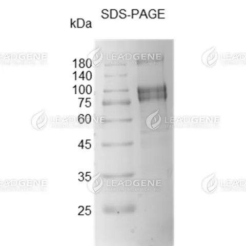 SDS-PAGE analysis of SARS-CoV-2 Trimeric Spike Protein (Beta B1.351 Variant).