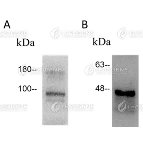 SARS-CoV-2 Virus-Like Particles B.1.1.7 (Alpha)