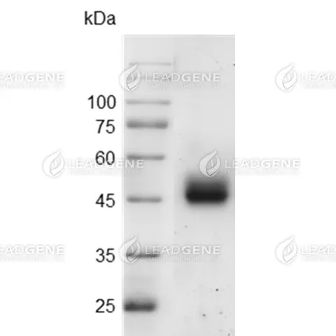 SARS-CoV-2 Spike Protein RBD (Delta B1.617.2 Variant), His-SUMO Tag, HEK293