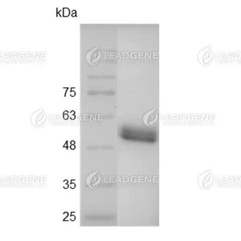 SARS-CoV-2 Spike Protein RBD, His-SUMO Tag, HEK293