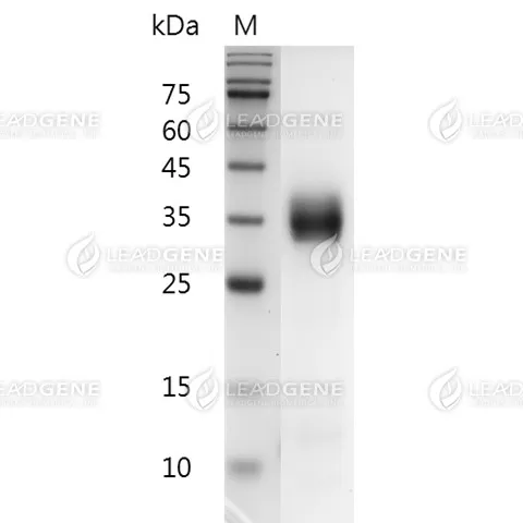 Monkeypox Virus (MPXV) A29L Protein, His-SUMO Tag, HEK 293