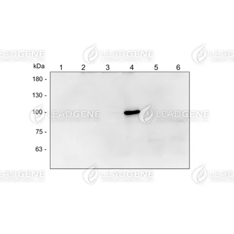 Western blotting analysis of Anti-DENV NS5 Antibody [Clone 37-2] Virus infection Vero cell lysates were stained with mouse anti-DENV NS5 monoclonal antibody at 1:1000 dilution. Lane 1: Vero cell lysate (10 μg), Lane 2: ZIKV infection (10 μg), Lane 3: DENV1 infection (10 μg), Lane 4: DENV2 infection (10 μg), Lane 5: DENV3 infection (10 μg), Lane 6: DENV4 infection (10 μg).