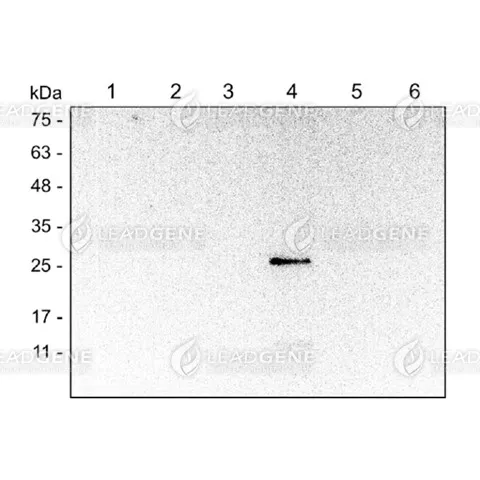 Western blotting analysis of Anti-DENV NS4B Antibody [Clone 24-1] Western blot: Virus infection BHK cell lysates were stained with mouse anti-DENV NS4B monoclonal antibody at 1:1000 dilution. Lane 1: BHK cell lysate (10 μg), Lane 2: ZIKV infection (10 μg), Lane 3: DENV1 infection (10 μg), Lane 4: DENV2 infection (10 μg), Lane 5: DENV3 infection (10 μg), Lane 6: DENV4 infection (10 μg).