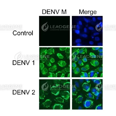 Anti-DENV M Antibody [Clone 31-1]