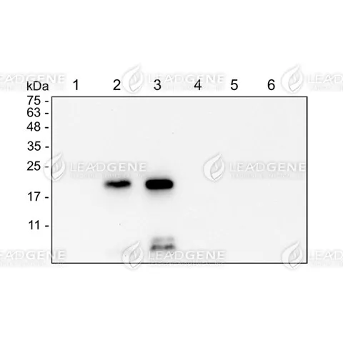 Western blotting analysis of Anti-DENV M Antibody [Clone 31-1] Virus infection C636 cell lysates were stained with mouse anti-DENV M monoclonal antibody at 1:1000 dilution. Lane 1: ZIKV infection (10 μg), Lane 2: DENV1 infection (10 μg), Lane 3: DENV2 infection (10 μg), Lane 4: DENV3 infection (10 μg), Lane 5: DENV4 infection (10 μg), Lane 6: C636 cell lysate (10 μg).