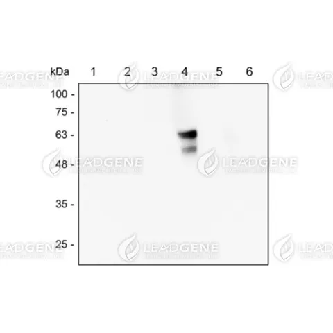 Western blotting analysis of DENV E antibody (1:1000) Lane 1: Vero cell lysate Lane 2: ZIKV-infected Vero cell lysate Lane 3: DENV1-infected Vero cell lysate Lane 4: DENV2-infected Vero cell lysate Lane 5: DENV3-infected Vero cell lysate Lane 6: DENV4-infected Vero cell lysate