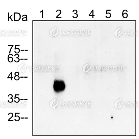 Western blotting analysis of Anti-ZIKV NS1 Antibody [Clone ZK51] Western blot: Virus infection Vero cell lysates were stained with mouse anti-ZIKV NS1 monoclonal antibody at 1:2000 dilution. Lane 1: Vero mock cell lysate (10 μg), Lane 2: Vero ZIKV cell lysate (10 μg), Lane 3: Vero DENV1 cell lysate (10 μg), Lane 4: Vero DENV2 cell lysate (10 μg), Lane 5: Vero DENV3 cell lysate (10 μg), Lane 6: Vero DENV 4 cell lysate (10 μg).
