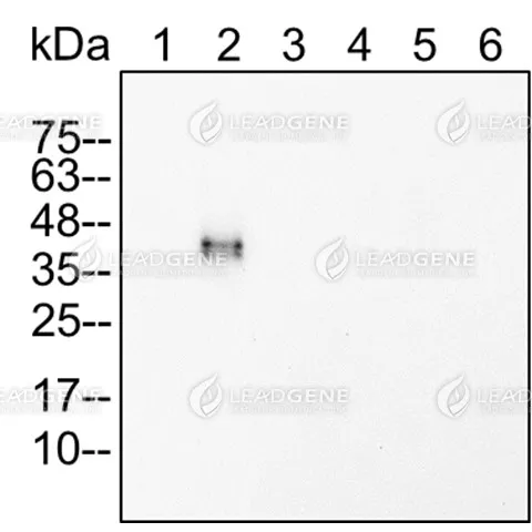 Western blotting analysis of Anti-ZIKV NS1 Antibody [Clone ZK243] Western blot: Virus infection Vero cell lysates were stained with mouse anti-ZIKV NS1 monoclonal antibody at 1:2000 dilution. Lane 1: Vero mock cell lysate (4 μg), Lane 2: Vero ZIKV cell lysate (4 μg), Lane 3: Vero DENV1 cell lysate (4 μg), Lane 4: Vero DENV2 cell lysate (4 μg), Lane 5: Vero DENV3 cell lysate (4 μg), Lane 6: Vero DENV 4 cell lysate (4 μg).