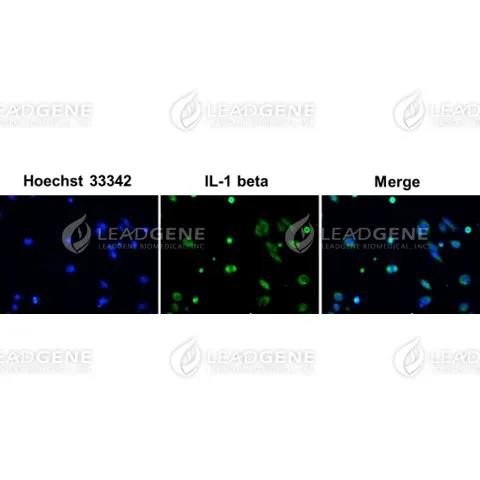 Anti-IL-1 Beta Antibody [Clone 4-1]