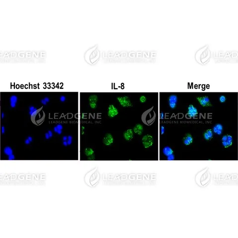 Anti-IL-8 Antibody [Clone 58-1]