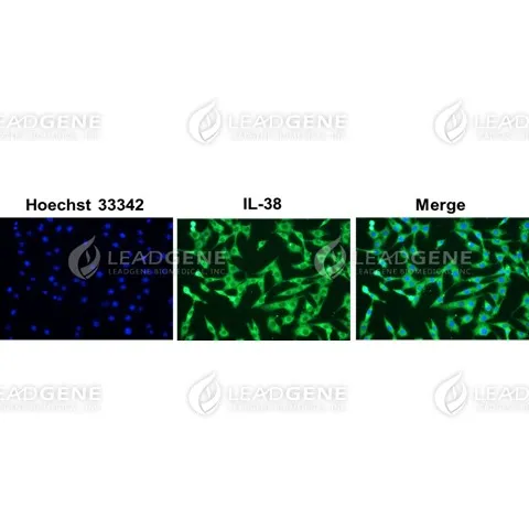 Anti-IL-38 Antibody [Clone 56-1]