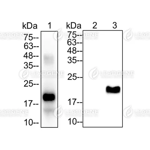 Western blotting analysis of Anti-IL-38 Antibody [Clone 56-1] Recombinant IL-38 protein and IL-38 transfected 293T cell lysates were stained with mouse anti-IL-38 monoclonal antibody at 1:5000 dilution. Lane 1: Recombinant IL-38 protein (50 ng). Lane 2: 293T cell lysates (30 μg). Lane 3: IL-38 transfected 293T cell lysates (30 μg).