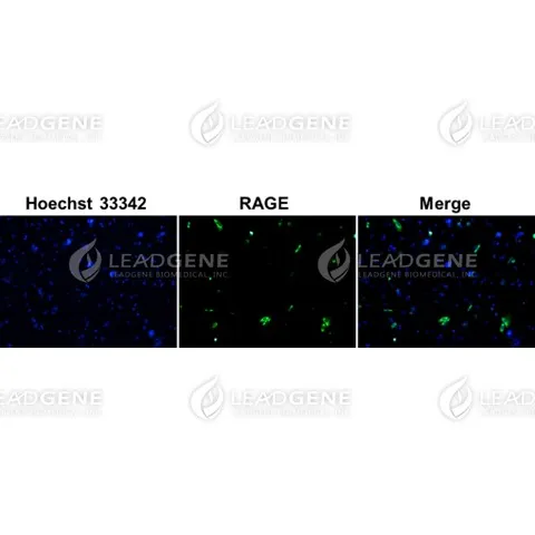 Anti-RAGE Antibody [Clone 16-1]