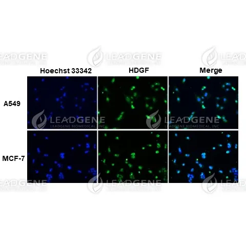 Anti-HDGF Antibody [Clone 83-5]