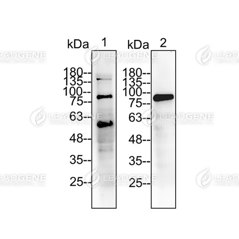 Western blotting analysis of Anti-HDGF Antibody [Clone 83-5] Tissue lysate was stained with anti-HDGF monoclonal antibody at 1:5000 dilution. Lane 1: Mouse liver lysate (50 μg). Lane 2: Rat liver lysate (50 μg).