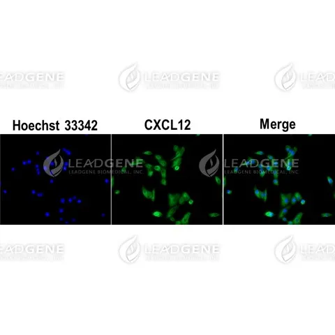 Anti-CXCL12 Antibody [Clone 69-2]