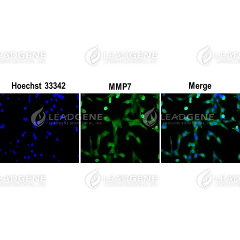 Anti-MMP7 Antibody [Clone 1-4]