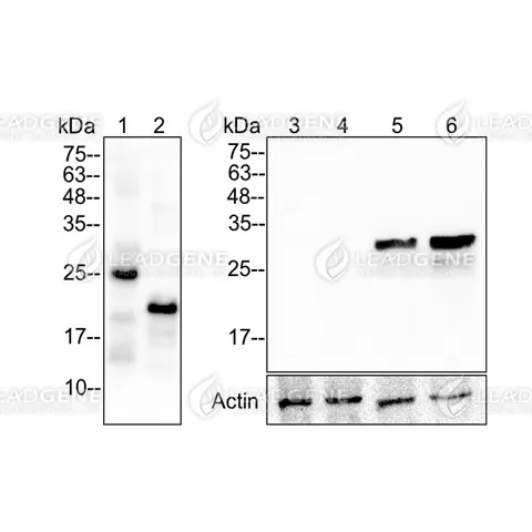 Western blotting analysis of Anti-MMP7 Antibody [Clone 1-4] Recombinant proteins and LPS treat MMP7 transfected 293T cell lysates were stained with mouse anti-MMP7 (1-4) monoclonal antibody at 1:5000 dilution. Lane 1: recombinant MMP7 (proenzyme) protein (50 ng). Lane 2: recombinant MMP7 (active) protein (50 ng). Lane 3: 293T cell lysates (30 μg). Lane 4: lysates from LPS treat 293T cells (30 μg). Lane 5: MMP7 transfected 293T cell lysates (30 μg). Lane 6: lysates from LPS treat MMP7 transfected 293T cell lysates (30 μg). The expression of Actin was as the internal control.