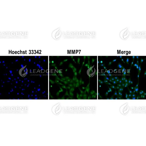 Anti-MMP7 Antibody [Clone 20-9]