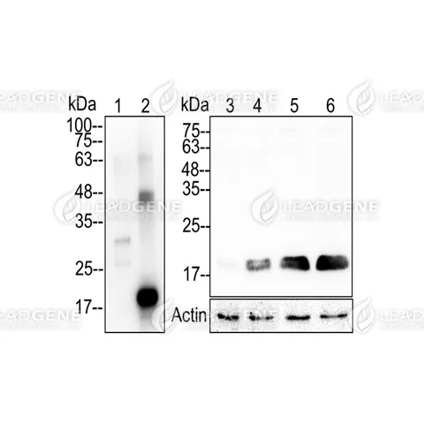 Western blotting analysis of Anti-MMP7 Antibody [Clone 20-9] Recombinant proteins and LPS treat MMP7 transfected 293T cell lysates were stained with mouse anti-MMP7 (20-9) monoclonal antibody at 1:5000 dilution. Lane 1: recombinant MMP7 (proenzyme) protein (50 ng). Lane 2: recombinant MMP7 (active) protein (50 ng). Lane 3: 293T cell lysates (30 μg). Lane 4: lysates from LPS treat 293T cells (30 μg). Lane 5: MMP7 transfected 293T cell lysates (30 μg). Lane 6: lysates from LPS treat MMP7 transfected 293T cell lysates (30 μg). The expression of Actin was as the internal control.