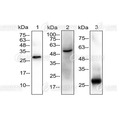 Western blotting analysis of Anti-GIF Antibody [Clone 50-1] Recombinant proteins and mouse stomach lysates were stained with mouse anti-GIF monoclonal antibody at 1:5000 dilution. Lane 1: Recombinant GIF protein (100 ng). Lane 2: Mouse stomach lysate (30 μg). Lane 3: Human gastric juice (10 μL).